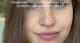 Embedded thumbnail for TM Mezoretin Face Tonic + Ha Professional Use Step 2 / Тоник для умывания с гиалуроновой кислотой